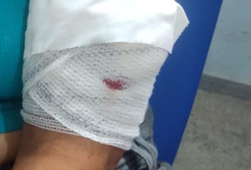 Homem é preso após agredir companheira com golpe de faca em Guanambi
